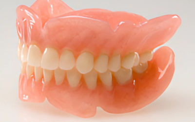 Complete Dentures