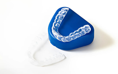 Invisalign (Invisible Braces)