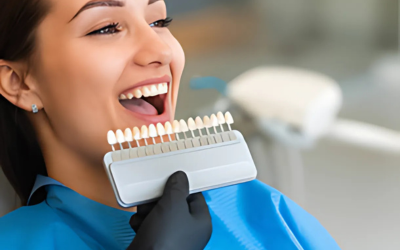 Smile Make-over